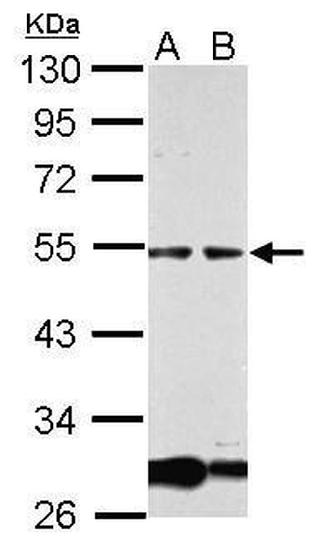 GCM1 Antibody in Western Blot (WB)