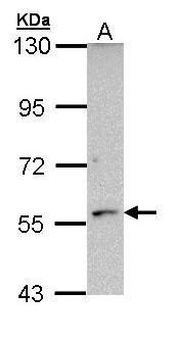 CYP21A2 Antibody in Western Blot (WB)