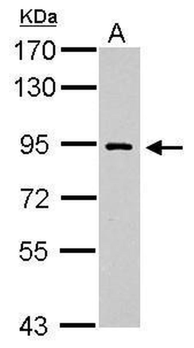 POLI Antibody in Western Blot (WB)