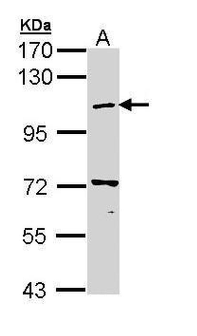 beta COP Antibody in Western Blot (WB)