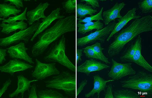 TUBA1A Antibody in Immunocytochemistry (ICC/IF)