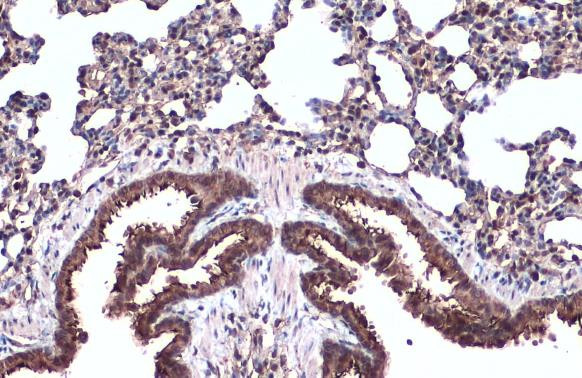 TUBA1A Antibody in Immunohistochemistry (Paraffin) (IHC (P))