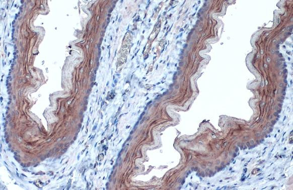 TUBA1A Antibody in Immunohistochemistry (Paraffin) (IHC (P))