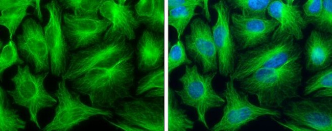 TUBA1A Antibody in Immunocytochemistry (ICC/IF)