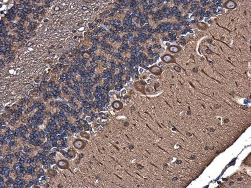 TUBA1A Antibody in Immunohistochemistry (Paraffin) (IHC (P))