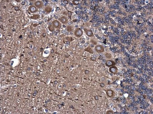 TUBA1A Antibody in Immunohistochemistry (Paraffin) (IHC (P))