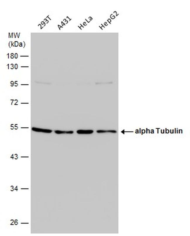 TUBA1A Antibody in Western Blot (WB)