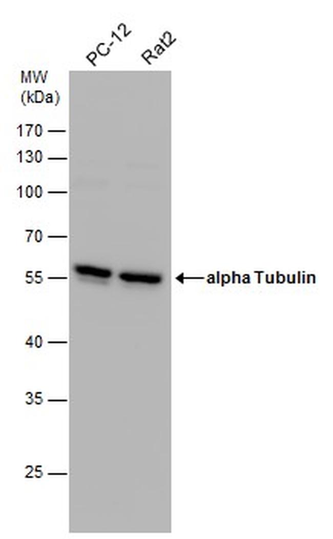 TUBA1A Antibody in Western Blot (WB)