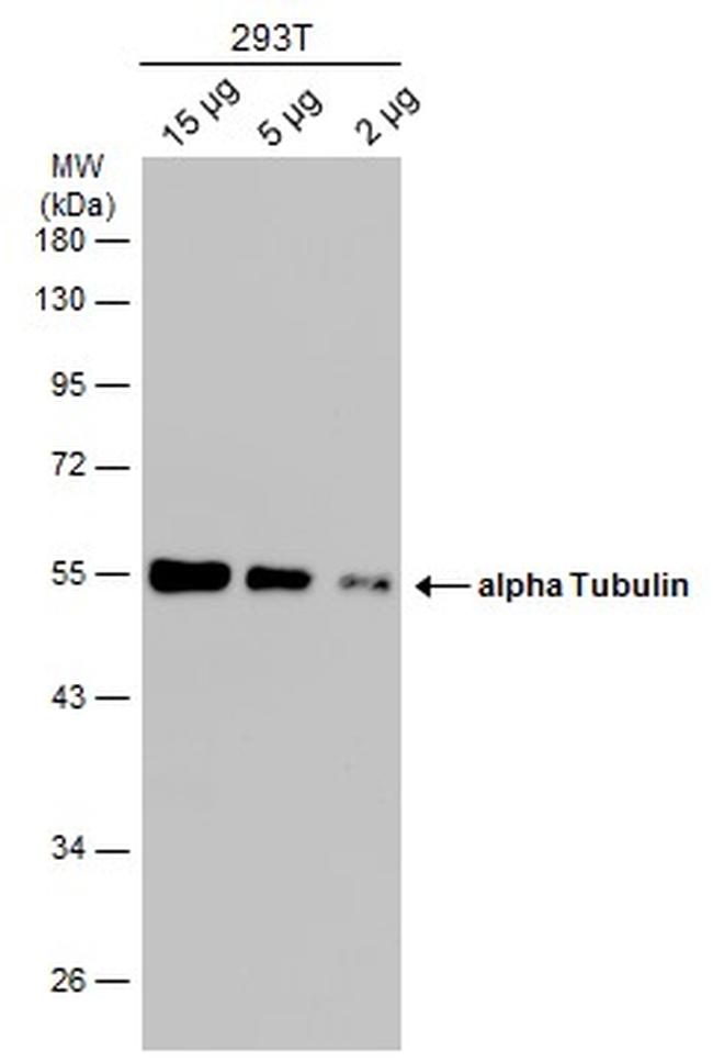 TUBA1A Antibody in Western Blot (WB)