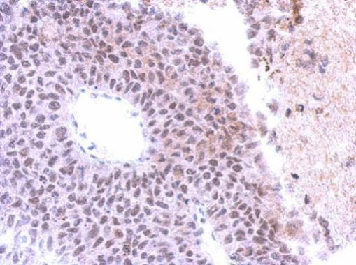 SAP130 Antibody in Immunohistochemistry (Paraffin) (IHC (P))