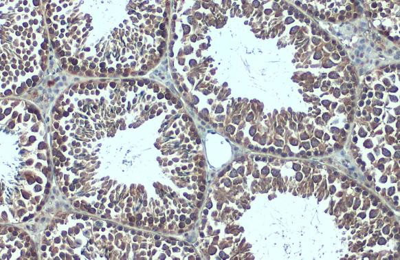 G3BP1 Antibody in Immunohistochemistry (Paraffin) (IHC (P))