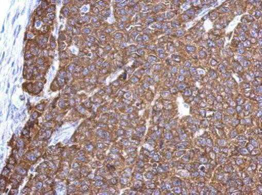 G3BP1 Antibody in Immunohistochemistry (Paraffin) (IHC (P))