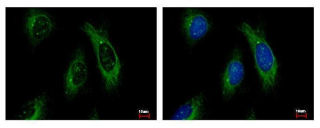 Cytokeratin 4 Antibody in Immunocytochemistry (ICC/IF)