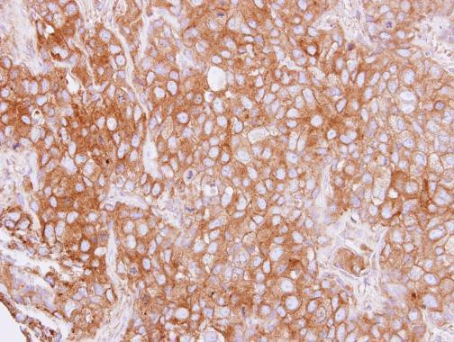 Cytokeratin 4 Antibody in Immunohistochemistry (Paraffin) (IHC (P))