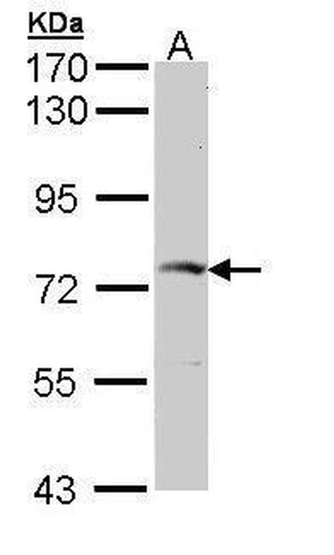 GGA2 Antibody in Western Blot (WB)