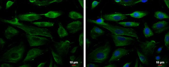 Fetuin B Antibody in Immunocytochemistry (ICC/IF)