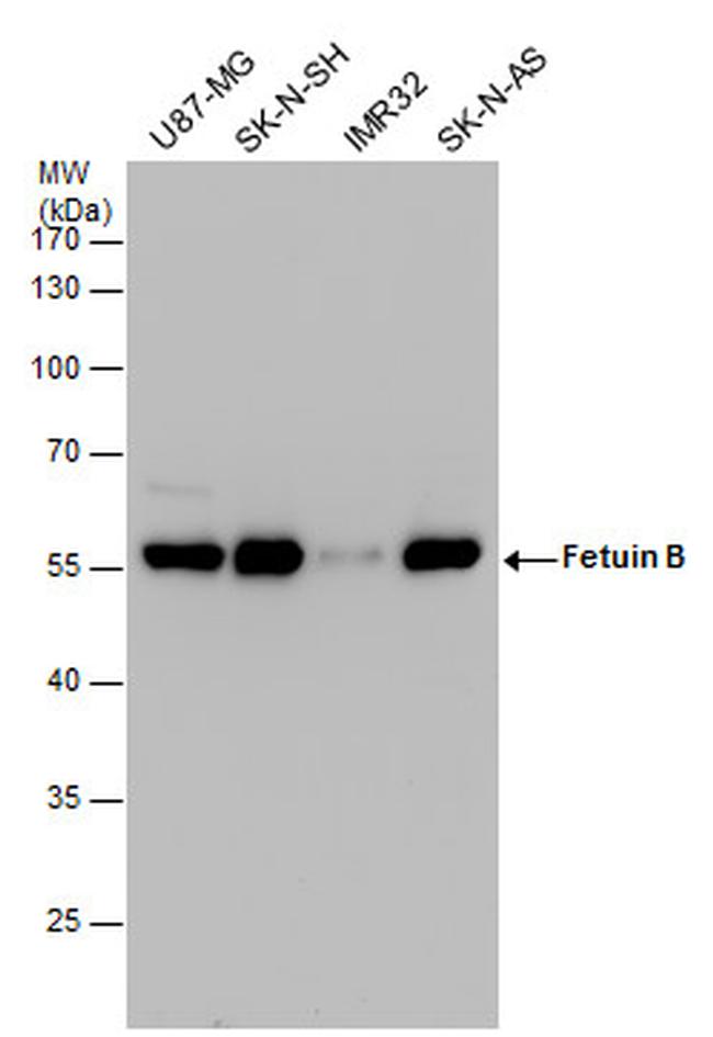 Fetuin B Antibody in Western Blot (WB)