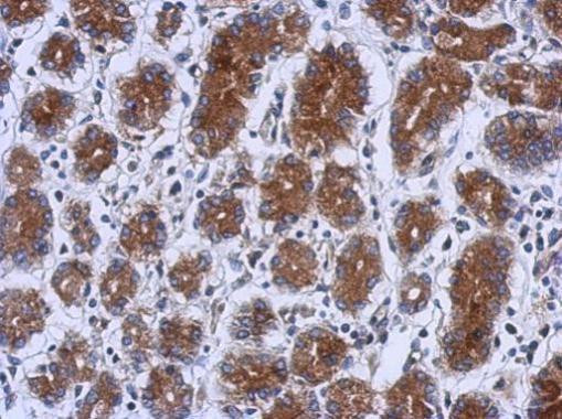 UPF1 Antibody in Immunohistochemistry (Paraffin) (IHC (P))