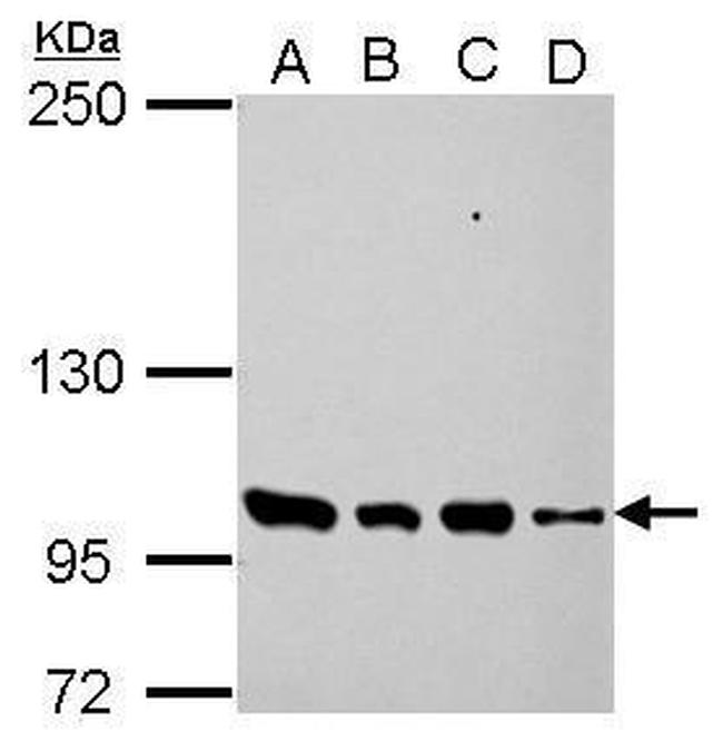 PDE3A Antibody in Western Blot (WB)