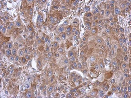 eIF3e Antibody in Immunohistochemistry (Paraffin) (IHC (P))