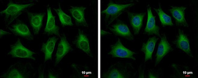 HMGCS1 Antibody in Immunocytochemistry (ICC/IF)