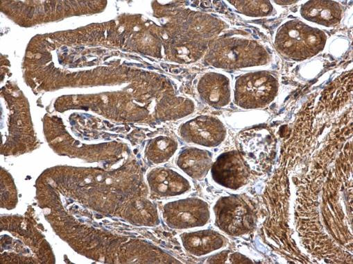 HMGCS1 Antibody in Immunohistochemistry (Paraffin) (IHC (P))