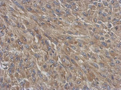 DYNC1I1 Antibody in Immunohistochemistry (Paraffin) (IHC (P))