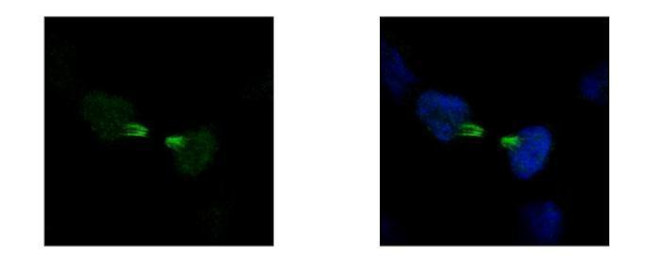 KID Antibody in Immunocytochemistry (ICC/IF)