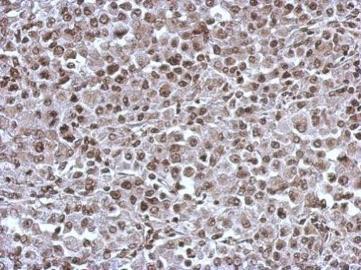 KID Antibody in Immunohistochemistry (Paraffin) (IHC (P))