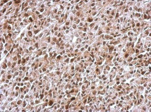 KID Antibody in Immunohistochemistry (Paraffin) (IHC (P))