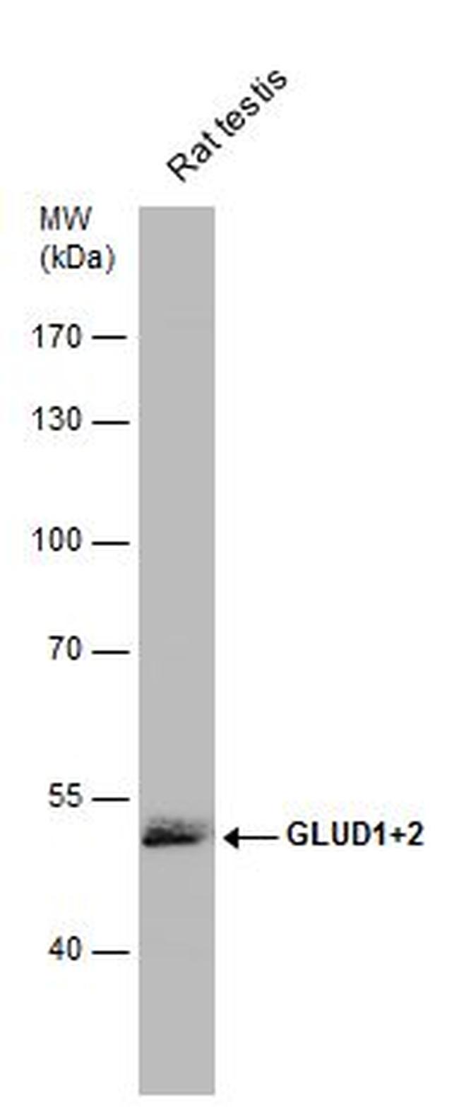 GluD1/GluD2 Antibody in Western Blot (WB)