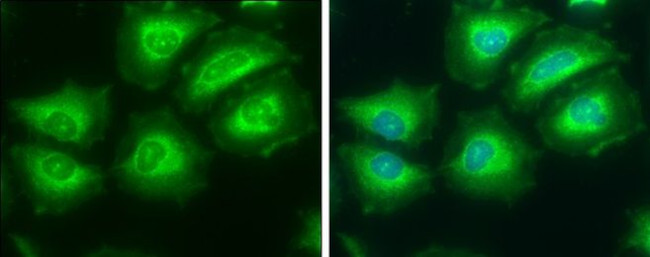 ATP Citrate Lyase Antibody in Immunocytochemistry (ICC/IF)