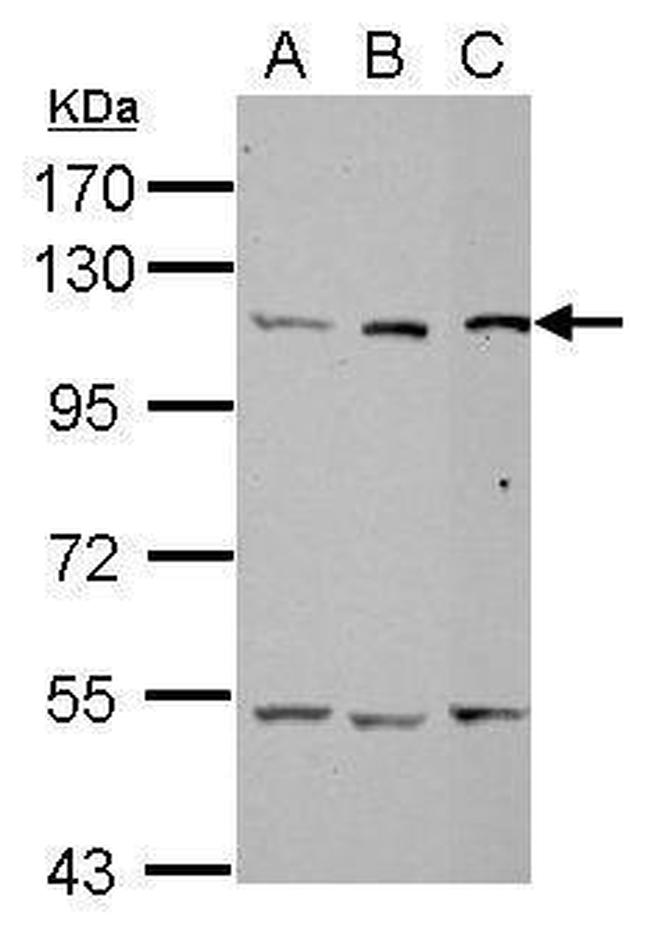 alanyl-tRNA Synthetase Antibody in Western Blot (WB)