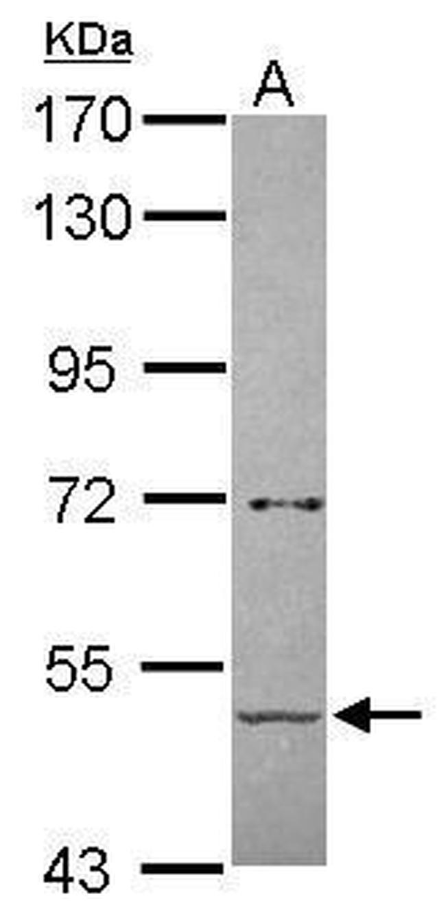 alpha Amylase 2B Antibody in Western Blot (WB)