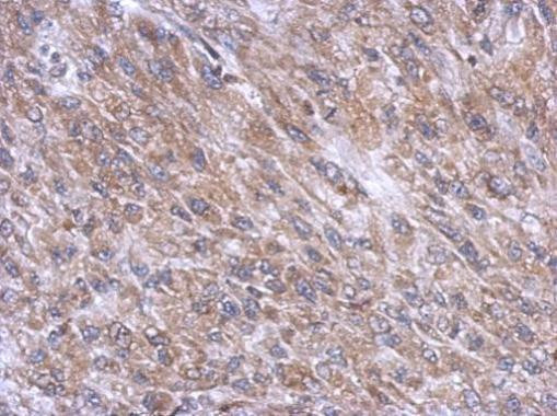 DYNC1I1 Antibody in Immunohistochemistry (Paraffin) (IHC (P))