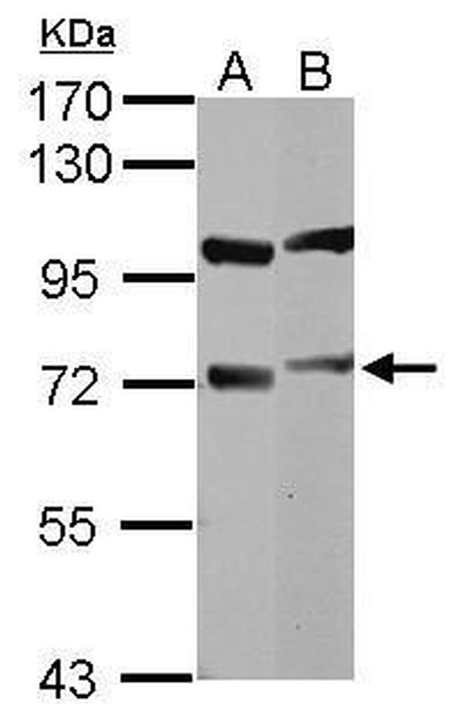 DYNC1I1 Antibody in Western Blot (WB)