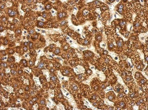 ACSL1 Antibody in Immunohistochemistry (Paraffin) (IHC (P))