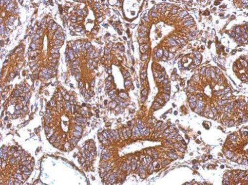 CTAGE5 Antibody in Immunohistochemistry (Paraffin) (IHC (P))