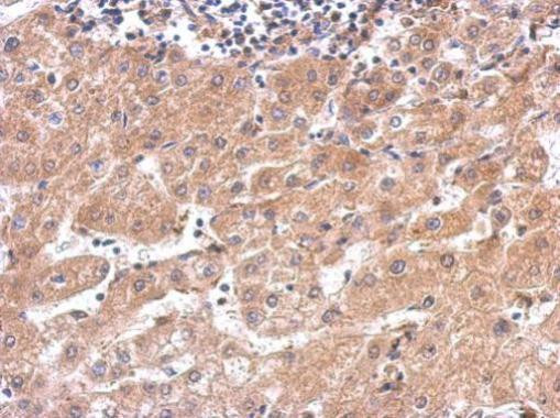 alanyl-tRNA Synthetase Antibody in Immunohistochemistry (Paraffin) (IHC (P))