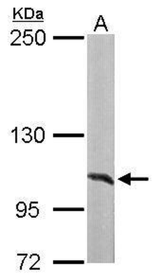 alanyl-tRNA Synthetase Antibody in Western Blot (WB)