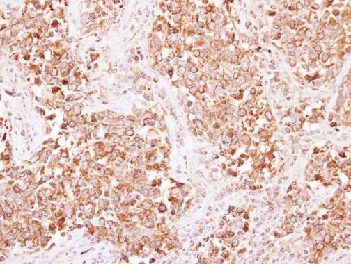 beta-2 Adaptin Antibody in Immunohistochemistry (Paraffin) (IHC (P))