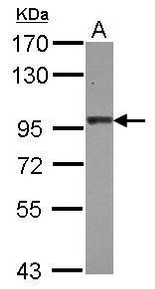 beta-2 Adaptin Antibody in Western Blot (WB)