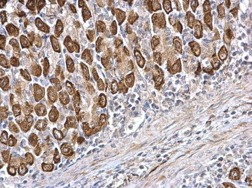 CDS1 Antibody in Immunohistochemistry (Paraffin) (IHC (P))