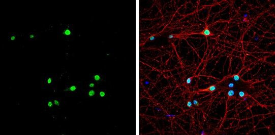 MBNL1 Antibody in Immunocytochemistry (ICC/IF)