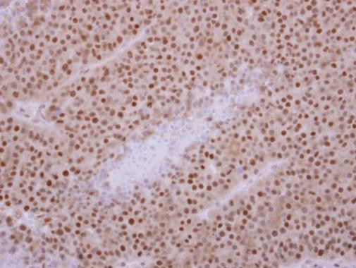 KIF3C Antibody in Immunohistochemistry (Paraffin) (IHC (P))