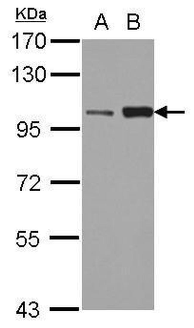 KIF3C Antibody in Western Blot (WB)