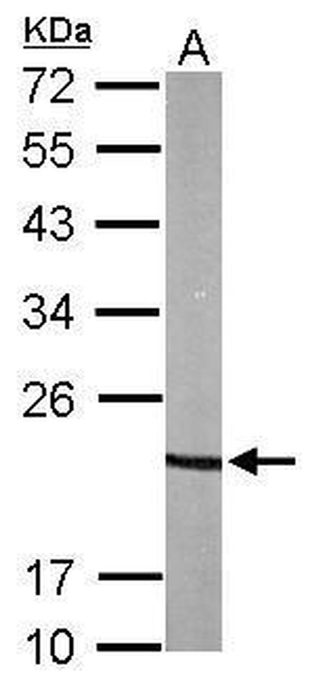 p23 Antibody in Western Blot (WB)