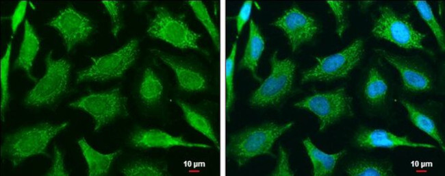 MUL1 Antibody in Immunocytochemistry (ICC/IF)