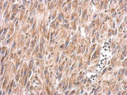 MUL1 Antibody in Immunohistochemistry (Paraffin) (IHC (P))