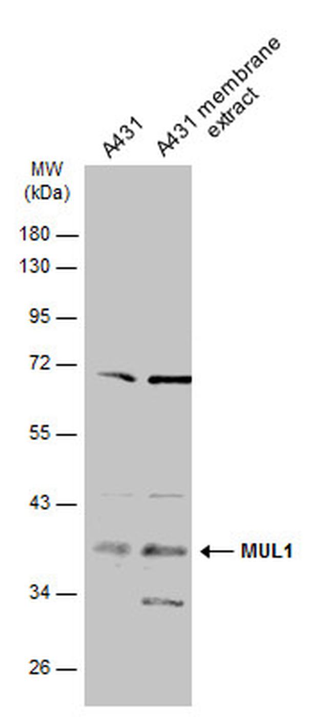 MUL1 Antibody in Western Blot (WB)